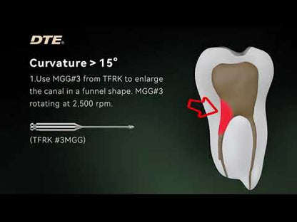 TFRK (Yoshi Terauchi File Removal Kit)